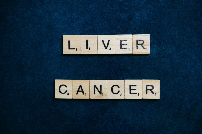 liver cancer care