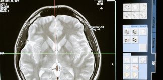 Brain Cancer : Causes, Symptoms, and Treatment Brain Tumor Treatment